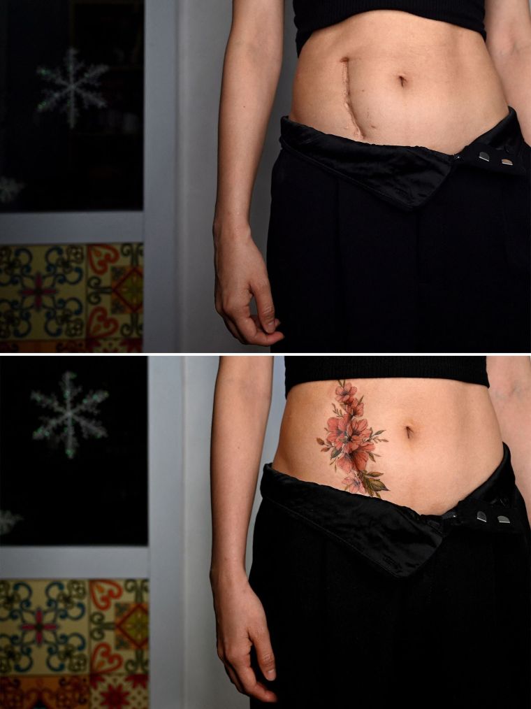 Vietnamese Tattoo Artist: Transforming Scars into Art_fororder_VCG111324926742