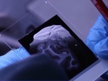 中国脑图谱研究系列成果集中发布 珍贵数据供国内外学者研究