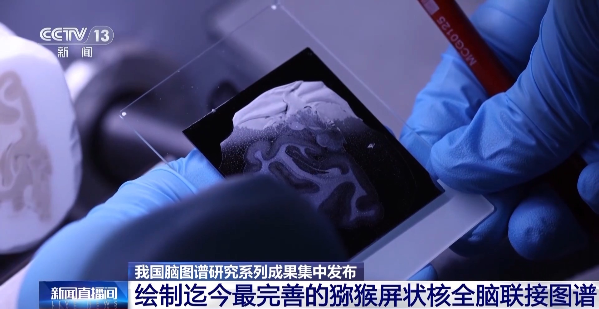 中国脑图谱研究系列成果集中发布 珍贵数据供国内外学者研究
